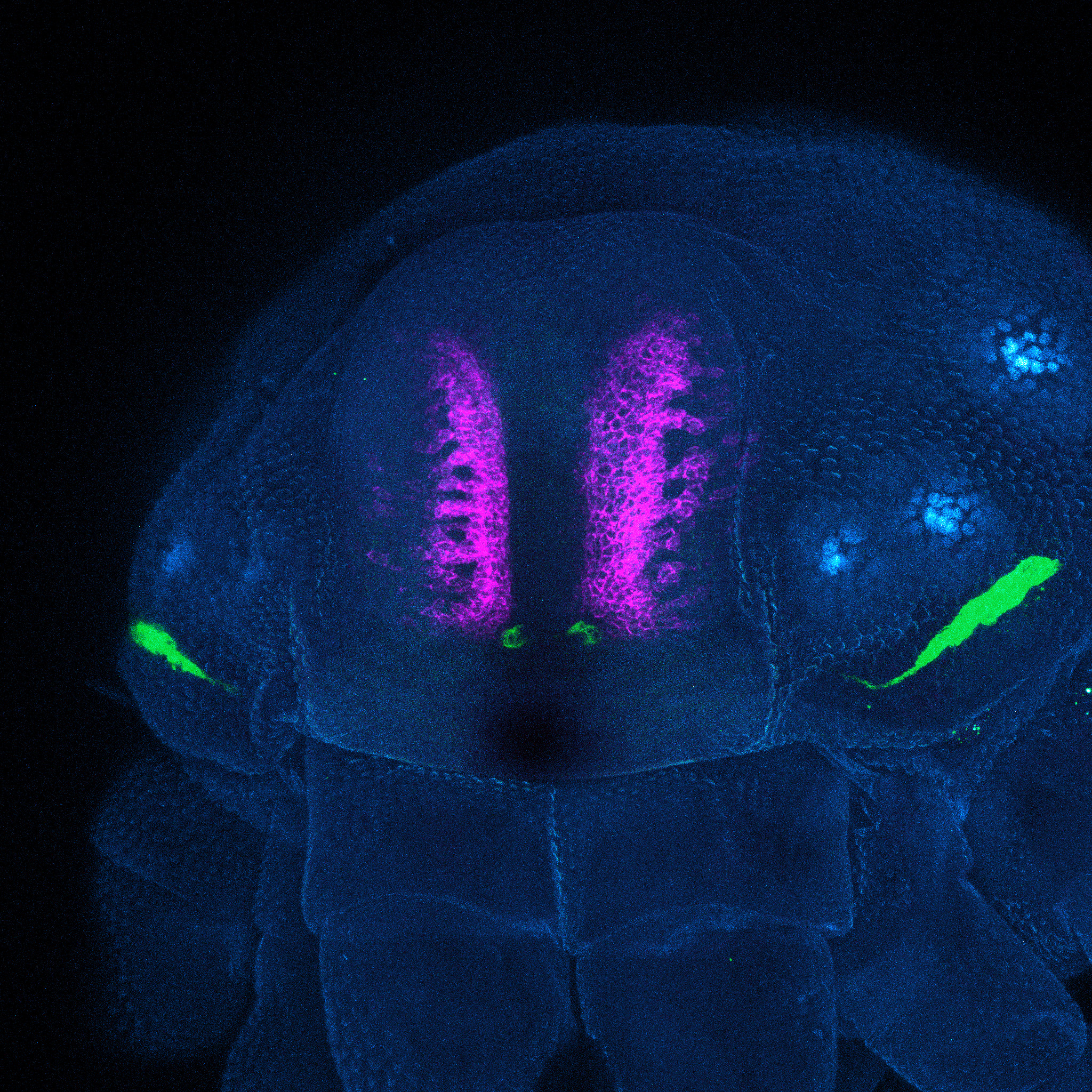 The head of a daddy longlegs under a microscope. Patches of glowing magenta and green illuminate its head.