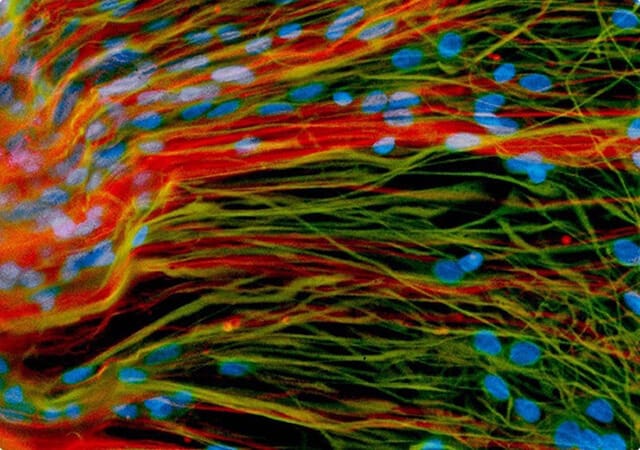 Color-enhanced image of stem cells