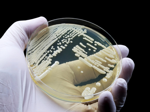 Hand wearing a medical glove shows a microbiological culture of the yeast Candida auris.
