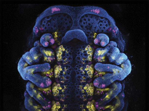 Photo of a a squat, teddy-bear-like bark scorpion embryo colored in dark blue with bright pink and yellow speckles.