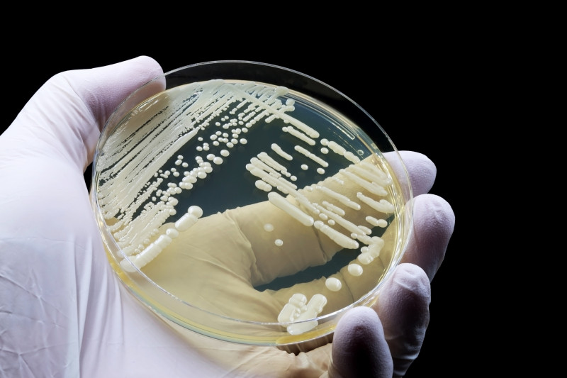 Hand wearing a medical glove shows a microbiological culture of the yeast Candida auris.