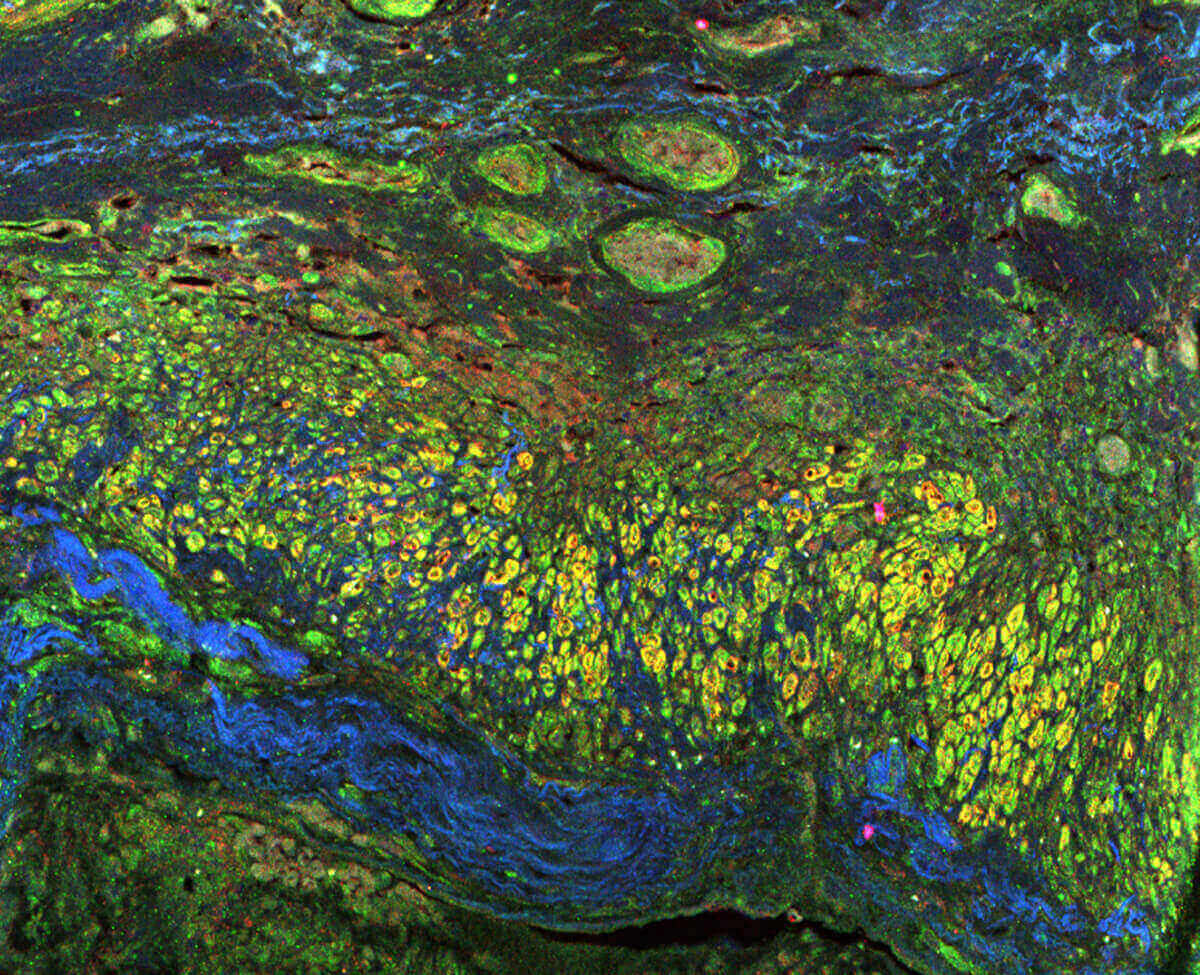 Human tissue and blood vessels look like the Water Lilies painting by Monet.